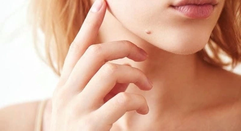 Khám phá ý nghĩa nhân tướng học của nốt ruồi dưới cằm