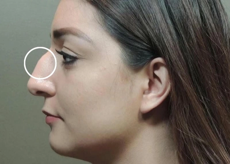 Khám phá tướng mũi gồ thể hiện tính cách con người như thế nào