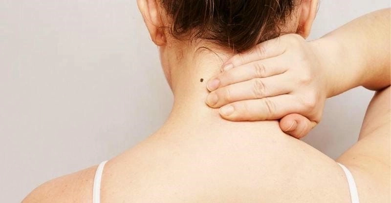 Khám phá ý nghĩa tướng số của nốt ruồi sau gáy