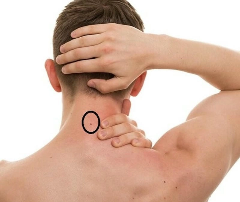 Giải mã luận đoán tính cách và vận mệnh qua nốt ruồi sau gáy