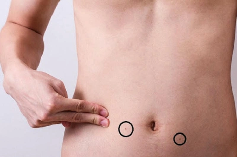 Giải mã đoán tính cách và vận mệnh qua nốt ruồi ở bụng