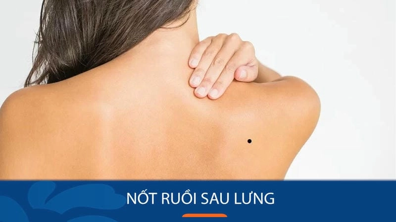 Khám phá xem tướng qua nốt ruồi trên lưng tiết lộ điều gì